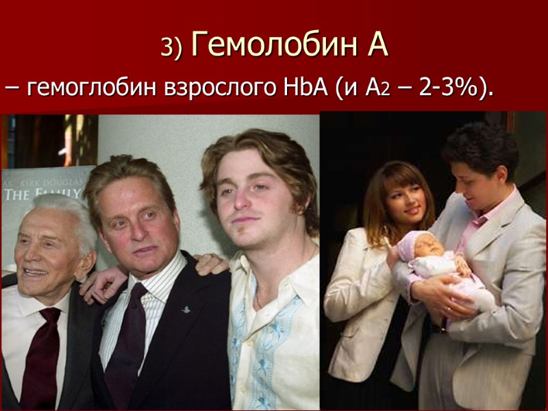 3) Гемолобин А  – гемоглобин взрослого HbА (и А2 – 2-3%).